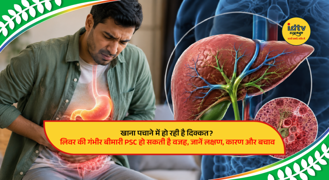 Illustration of a human liver and bile ducts highlighting Primary Sclerosing Cholangitis (PSC) and common digestive symptoms.
