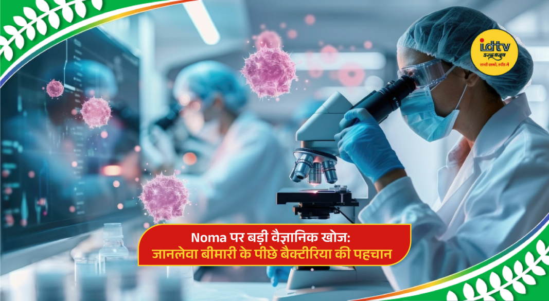 Microscopic view of bacteria linked to Noma disease affecting oral tissues in children.