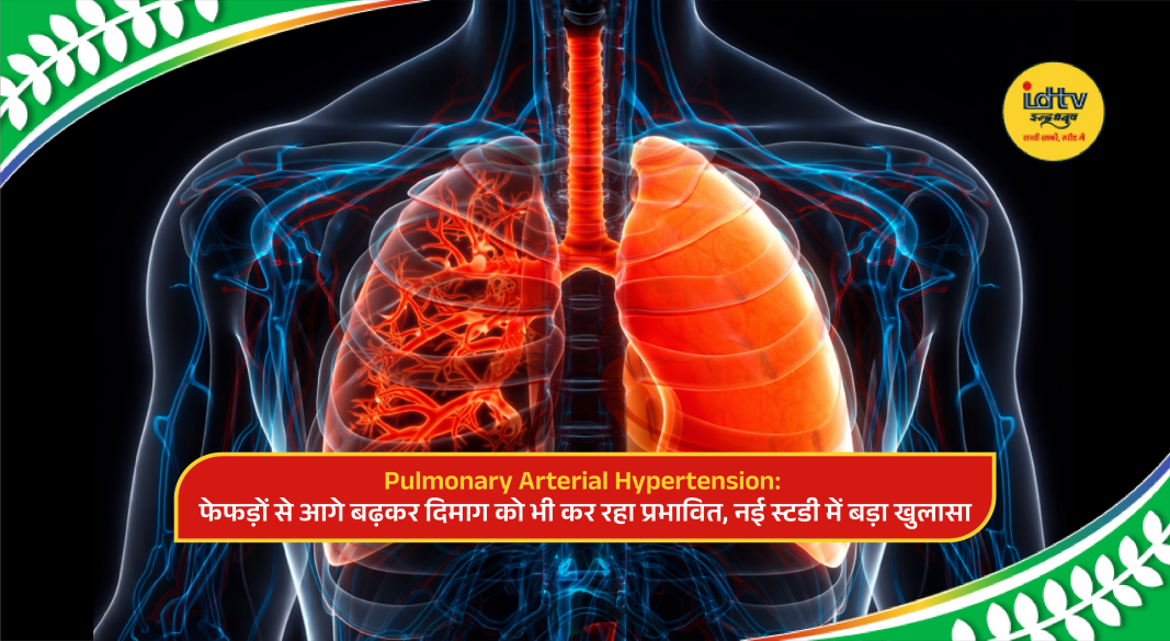 Illustration of pulmonary arterial hypertension showing affected lungs, heart, and brain inflammation.