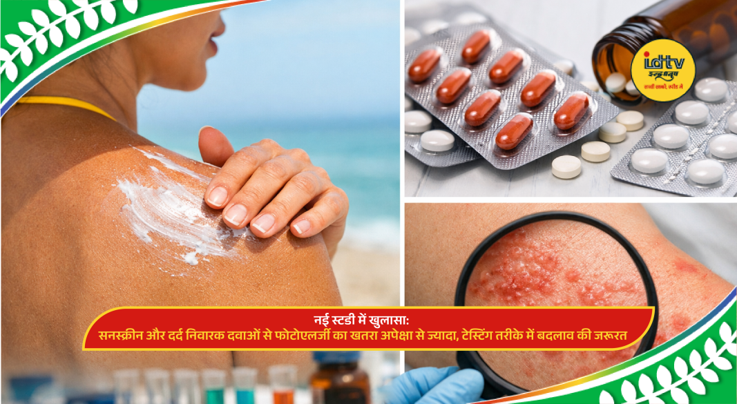 Person applying sunscreen with skin rash indicating photoallergic reaction caused by sunlight and medication