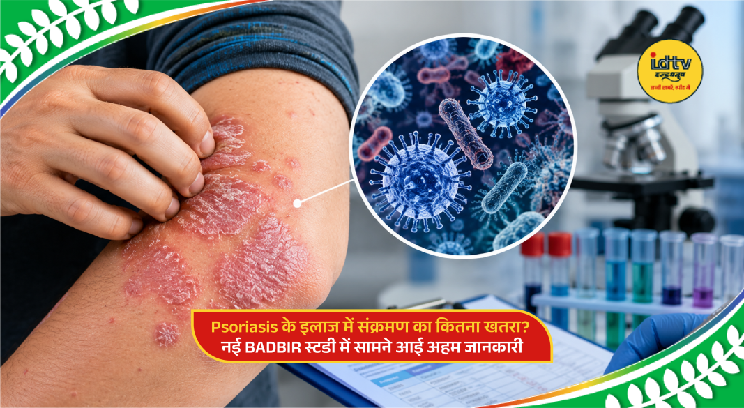 Doctor consulting psoriasis patient while discussing infection risks linked to systemic therapy treatment