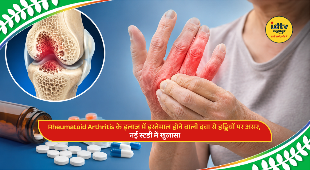 Rheumatoid arthritis patient consulting doctor about steroid treatment and bone density health risks