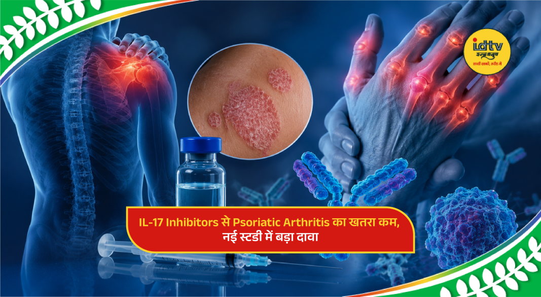 Medical illustration of psoriasis treatment showing IL-17 inhibitors reducing risk of psoriatic arthritis in patients