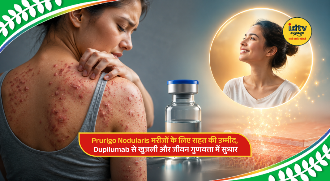 Doctor explaining Dupilumab treatment benefits for Prurigo Nodularis patients suffering from severe itching and skin lesions.